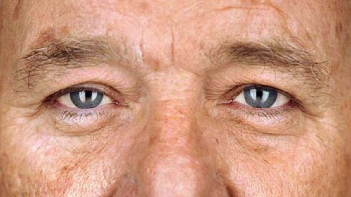 Close-up portrait showing two vertical catch light strips in the eyes